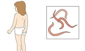 Síntomas de parasitos no corpo humano