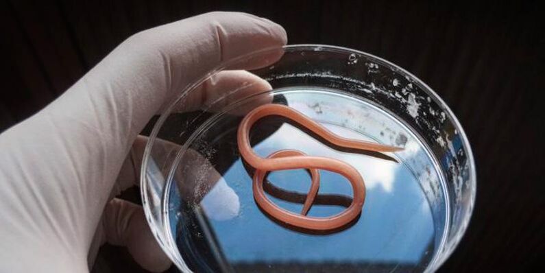 Ascaris é un helminto intestinal redondo que vive no sistema dixestivo