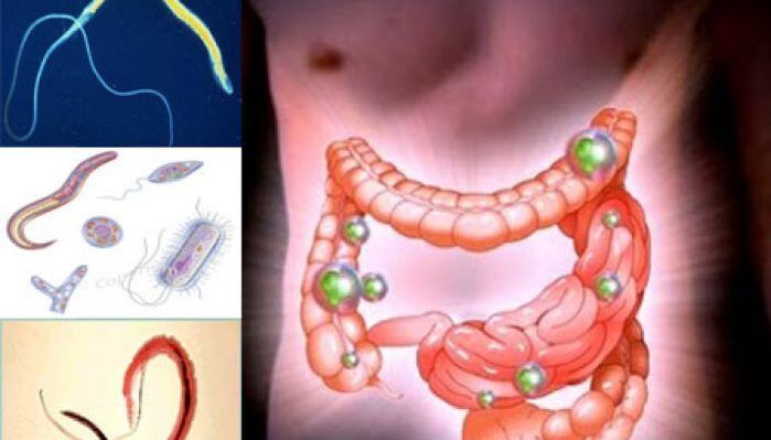 parasitos no intestino humano